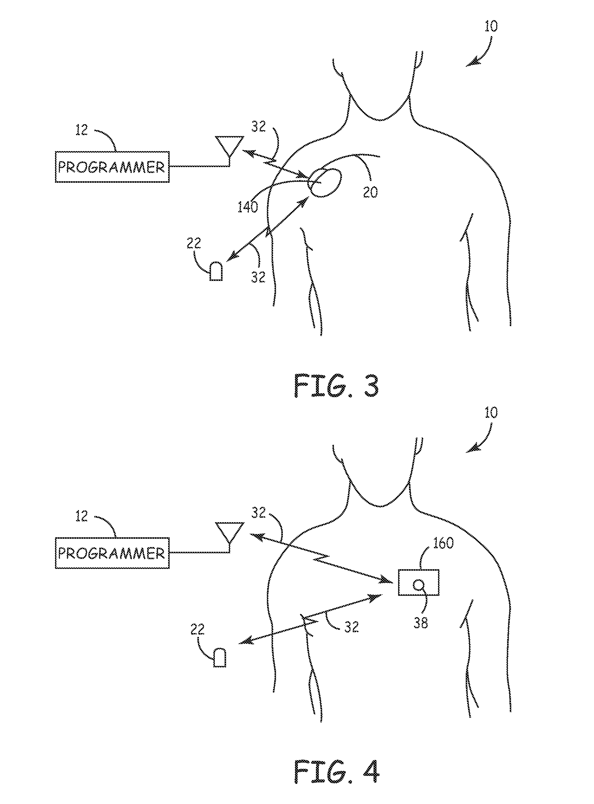 System and method for regulating cardiopulmonary triggered therapy to the brain