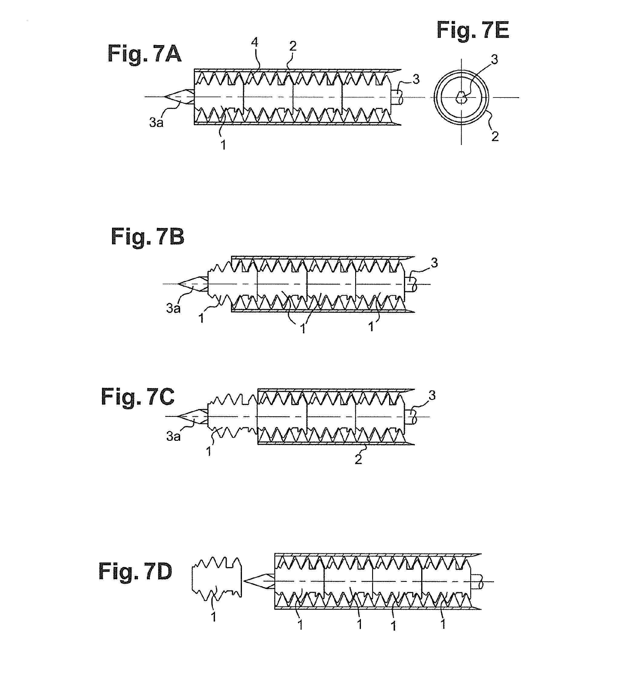 Device comprising a plurality of implants for the fixing of prosthetic material