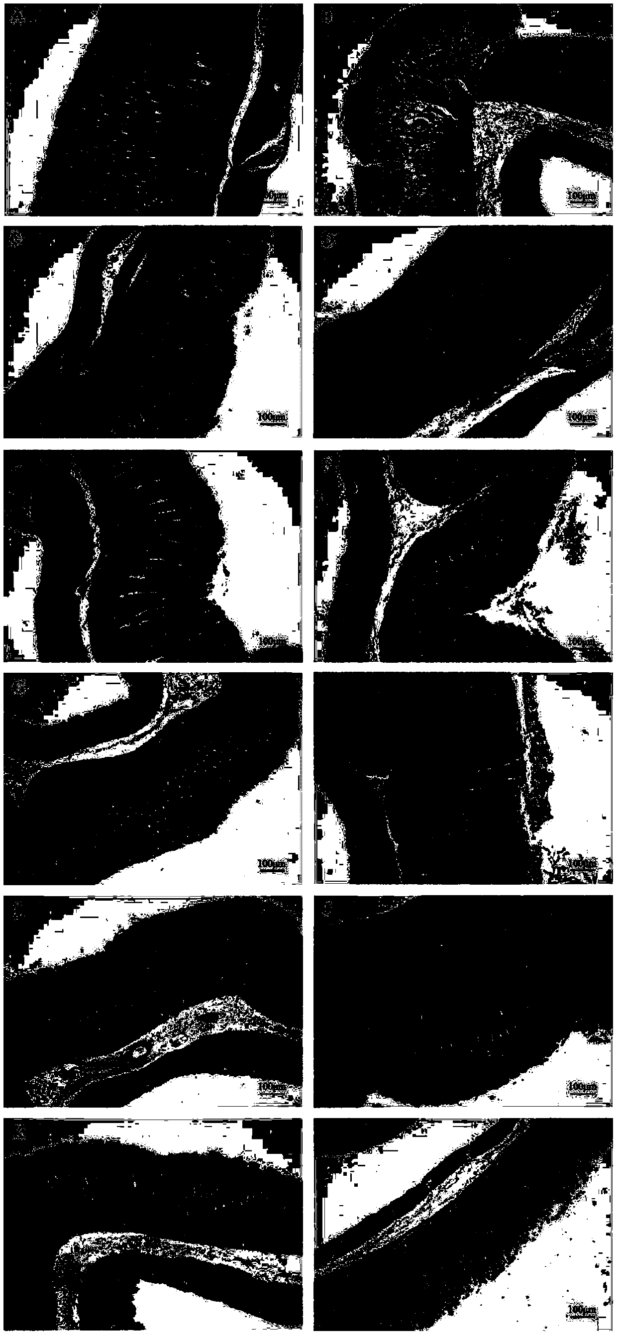 Composition with effect of improving acute gastric mucosal injury