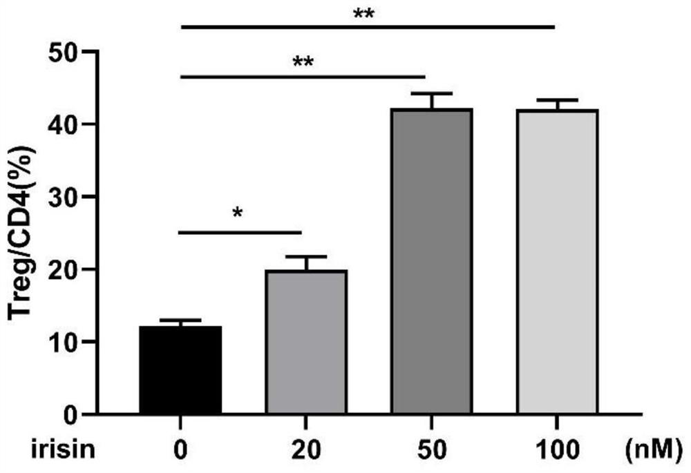 Application of tectoridin in preparation of medicine for treating autoimmune diseases and serious inflammatory diseases