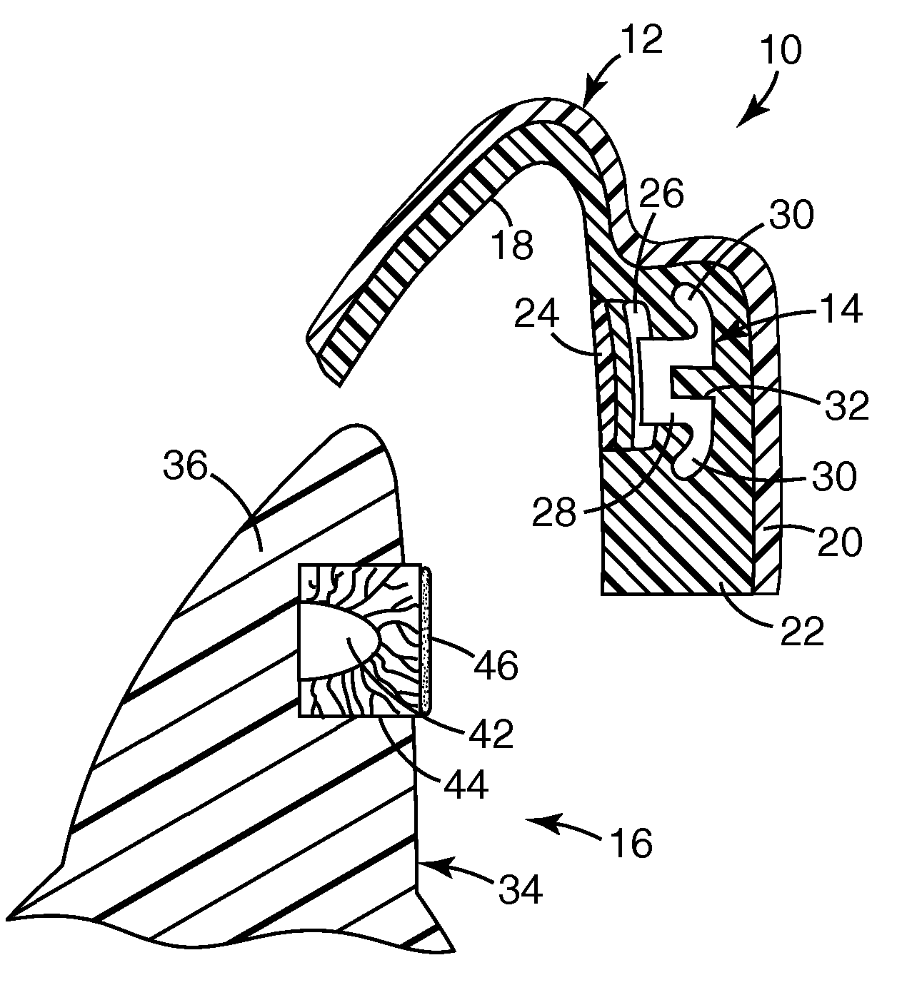 Orthodontic adhesive dispensing assembly