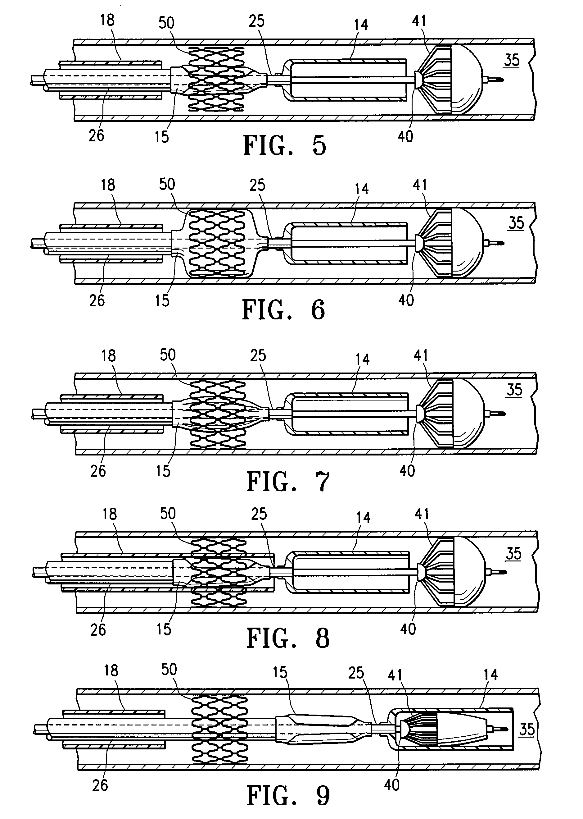 Highly trackable balloon catheter system and method for collapsing an expanded medical device