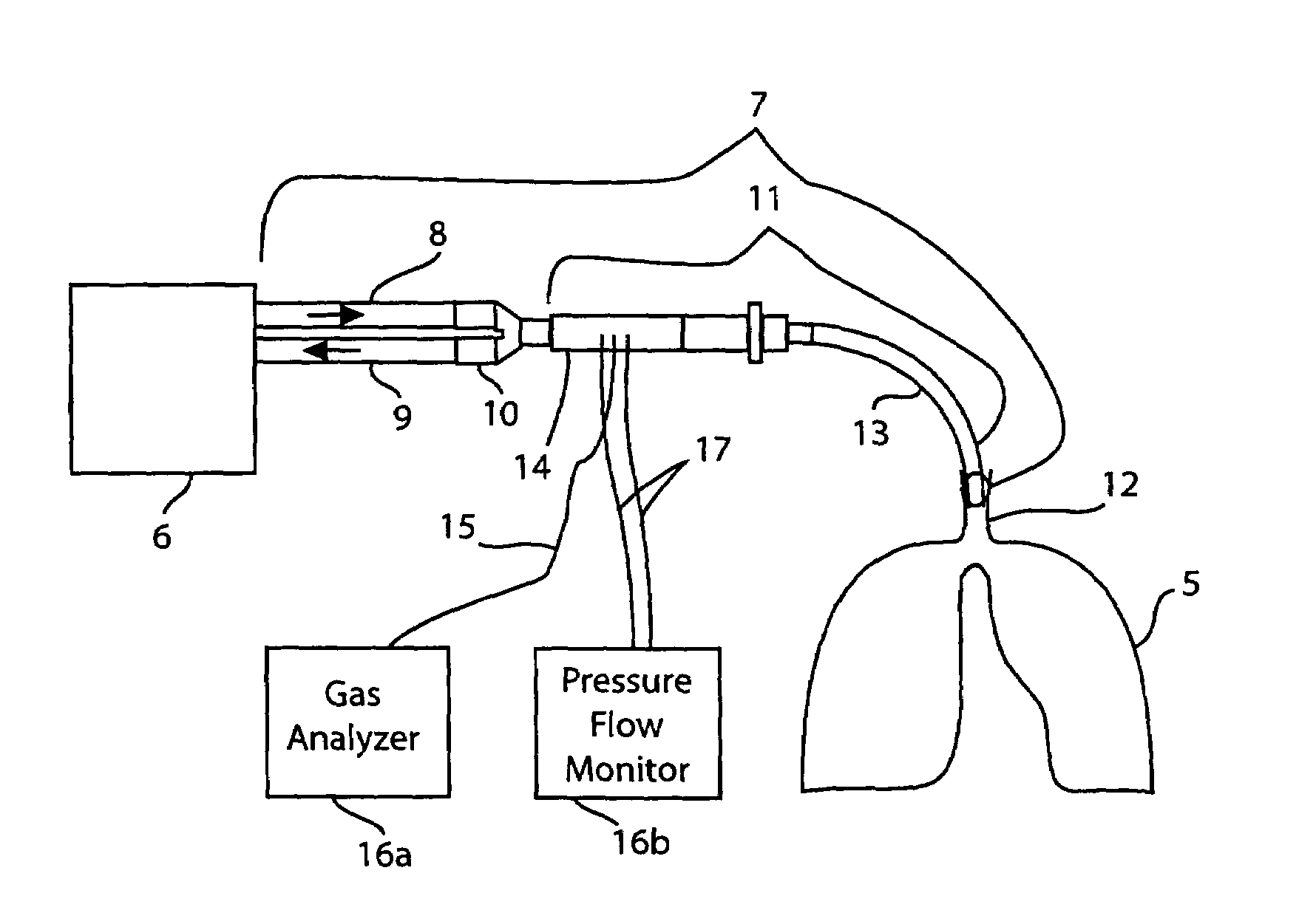 Method for indicating the amount of ventilation inhomogeneity in the lung