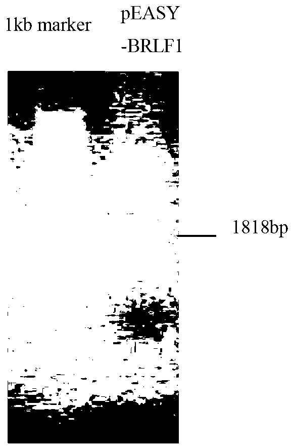 Preparation method for replication and transcription activator (Rta) protein and application of Rta protein to nasopharynx cancer detection reagent