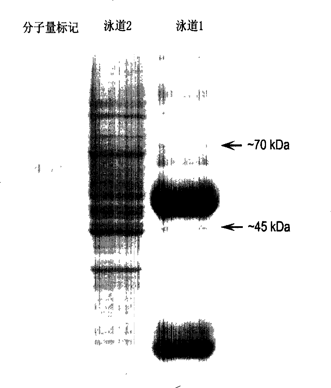 A method for detecting tumor-related markers in serum of patients with esophageal cancer