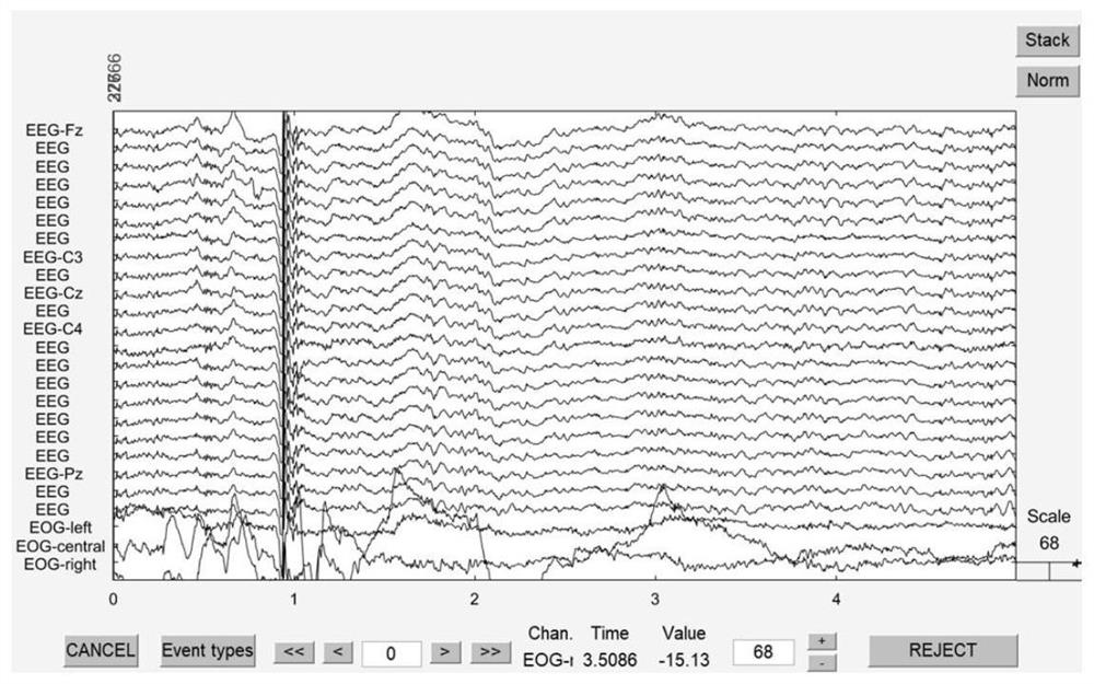 Brain wave analysis method based on Hilbert-Huang transform and support vector machine optimization