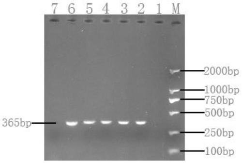 Specific primer and method for detecting Acinetobacter johnsonii and application