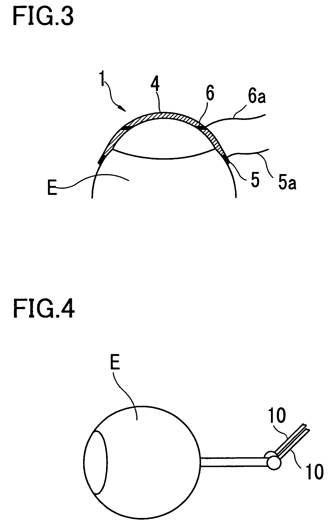 Ophthalmic treatment stimulation method for inhibiting death of retinal cells