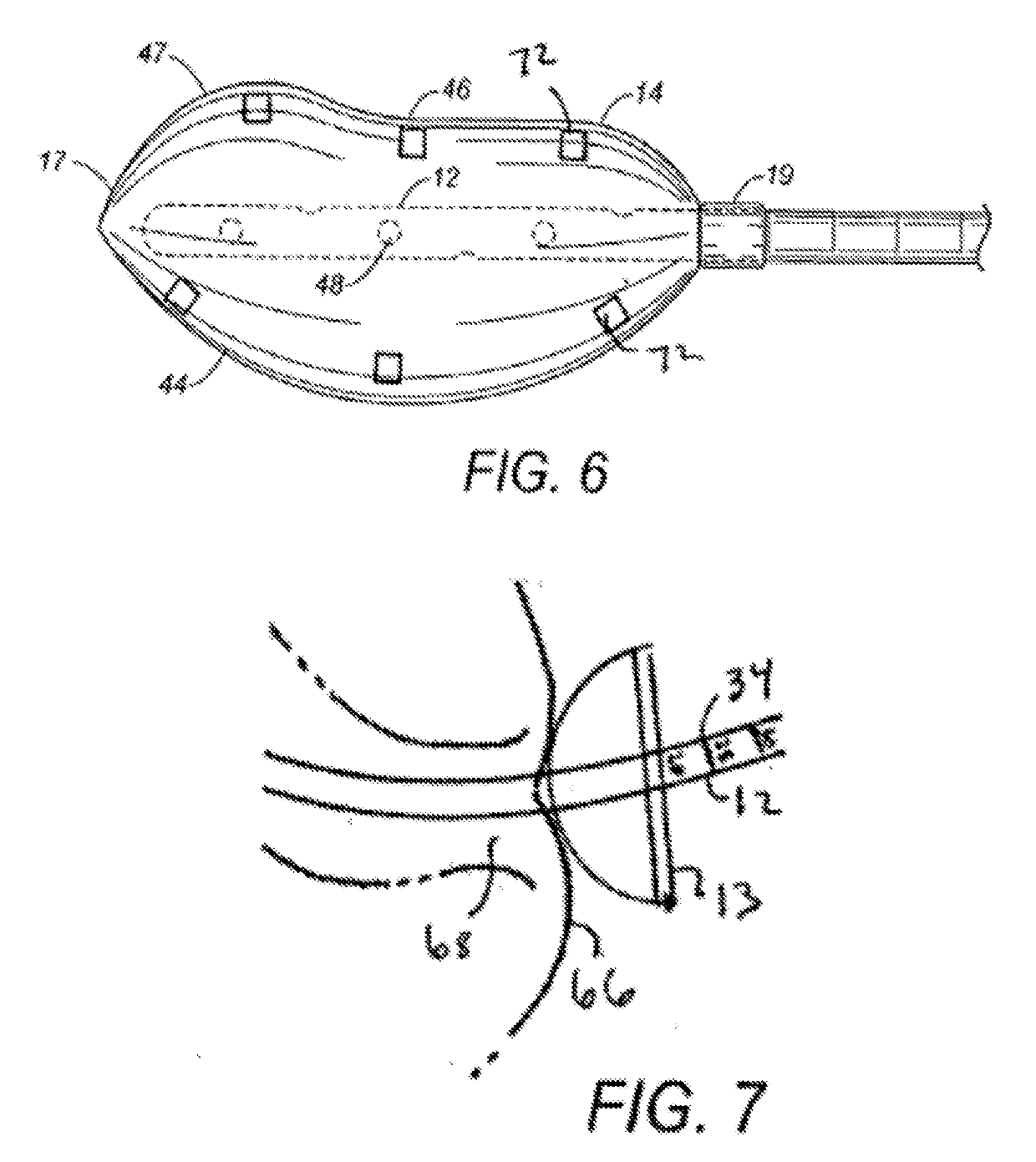 Rectal Balloon with Sensor Cable