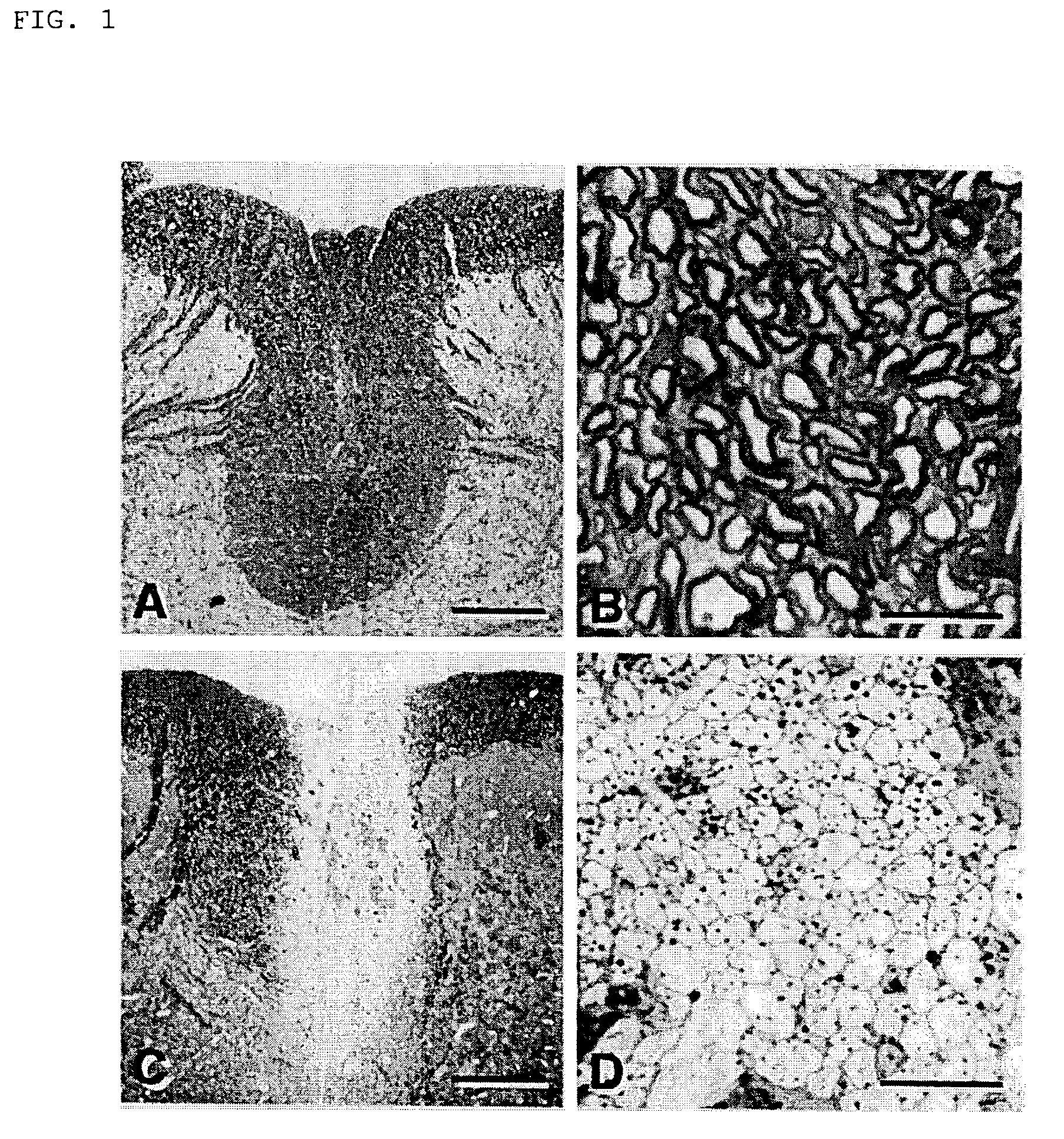 Method for remyelinating a demyelinized lesion due to injury in the brain or spinal cord