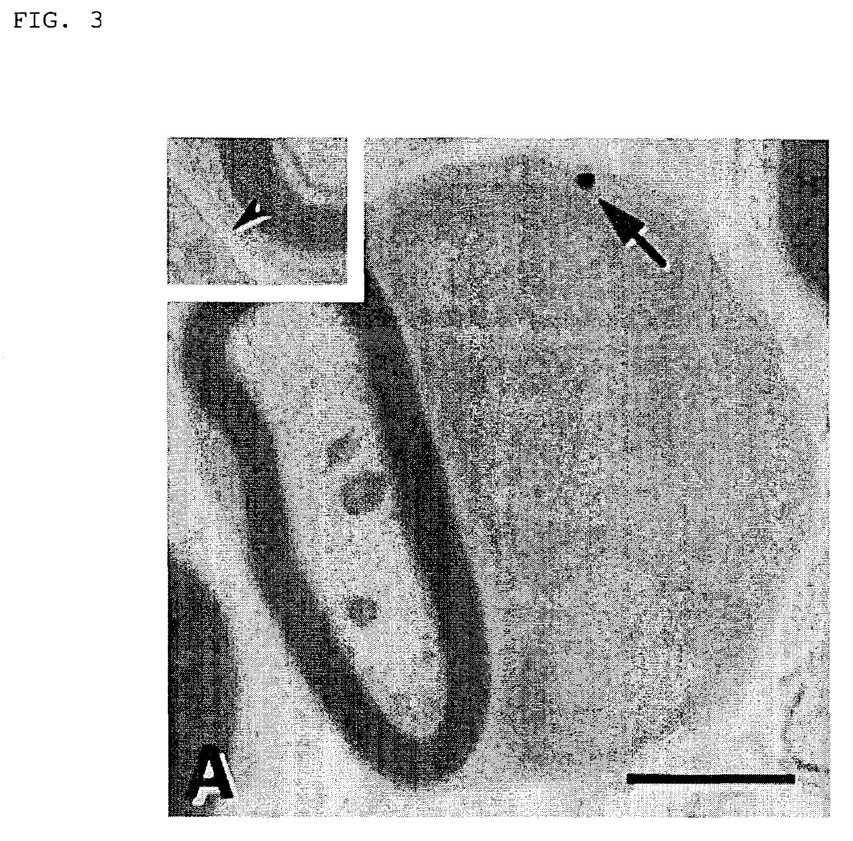 Method for remyelinating a demyelinized lesion due to injury in the brain or spinal cord