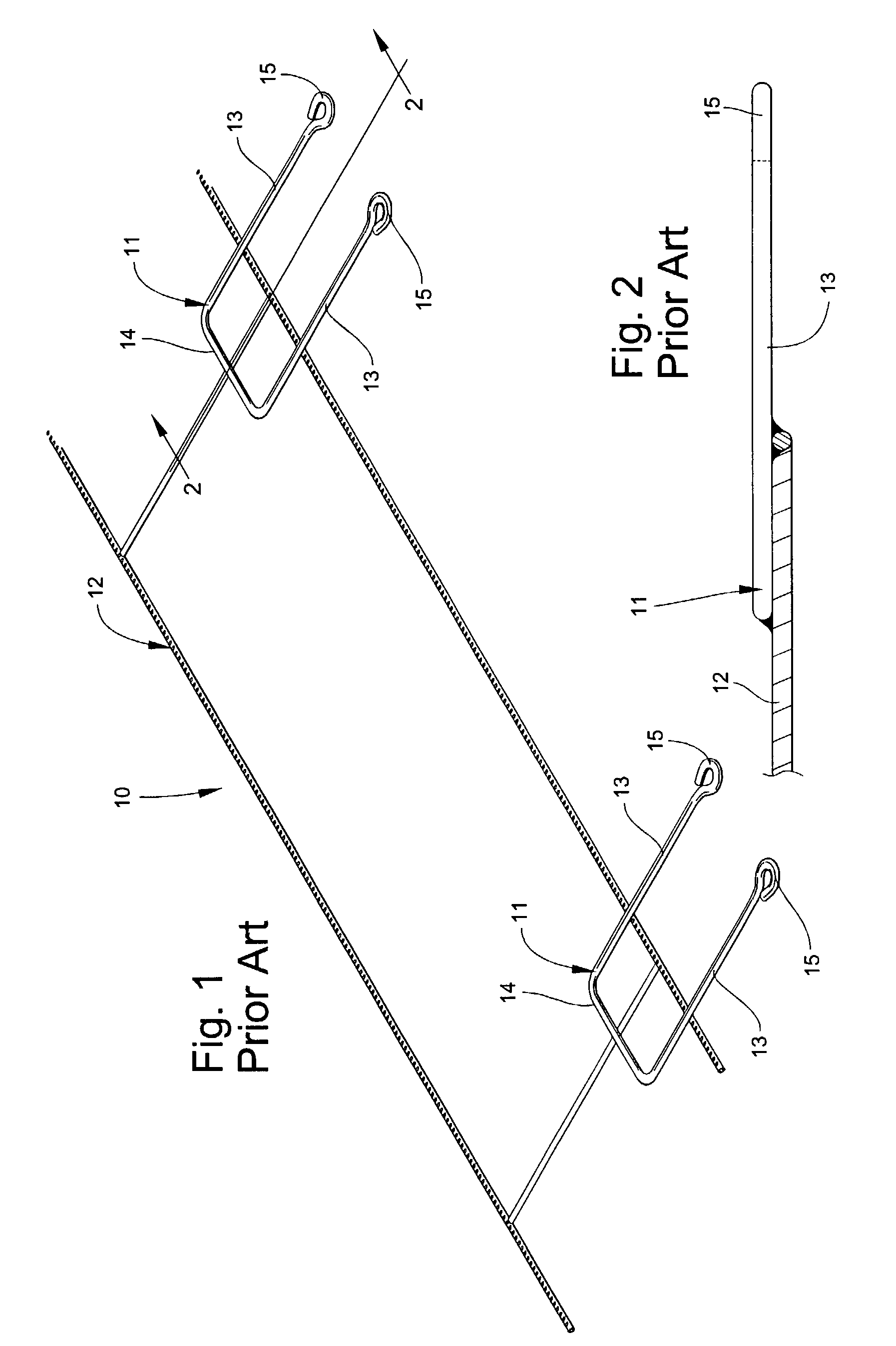 Masonry anchoring system