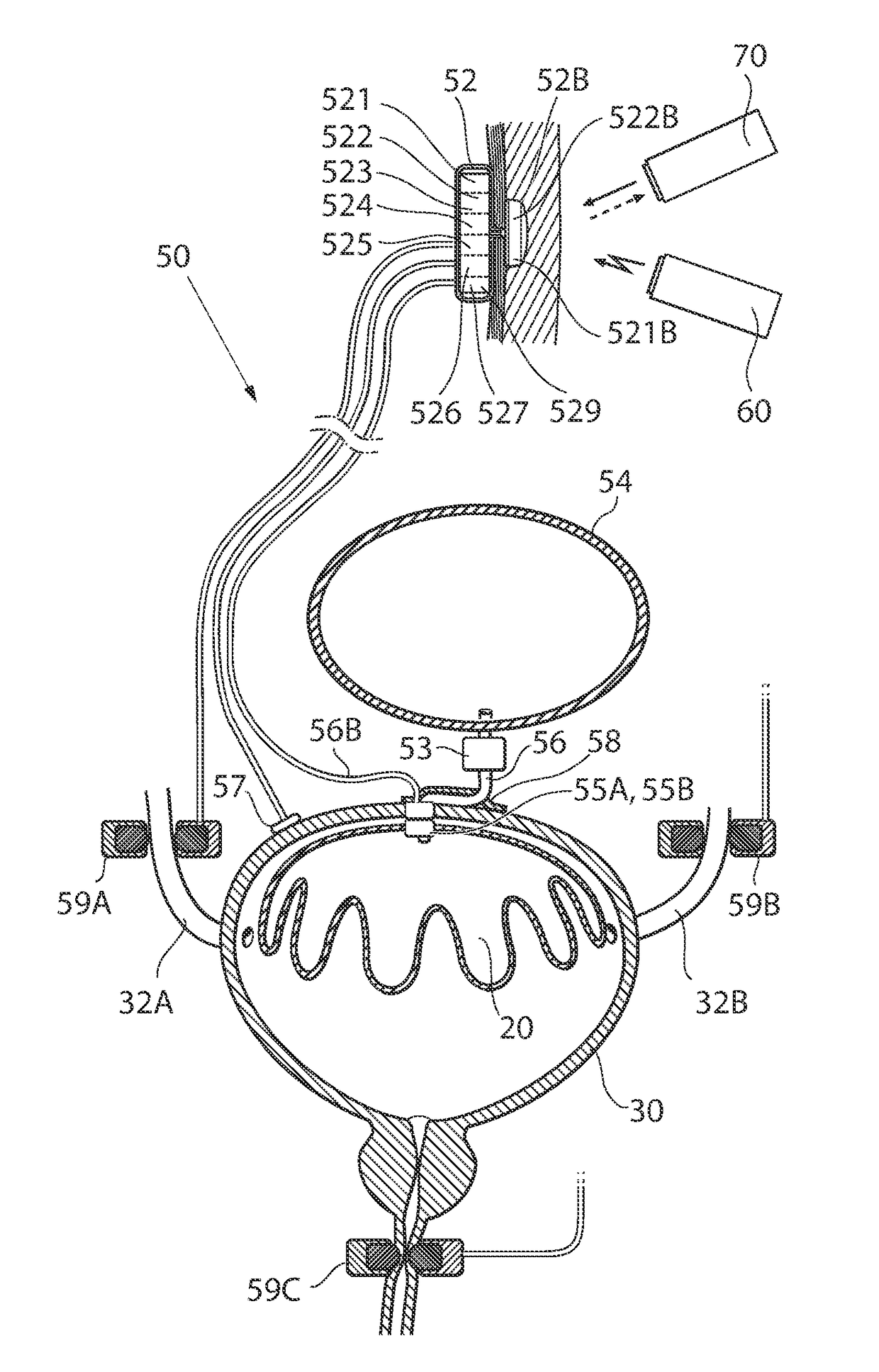 Implantable device for internal urinary control