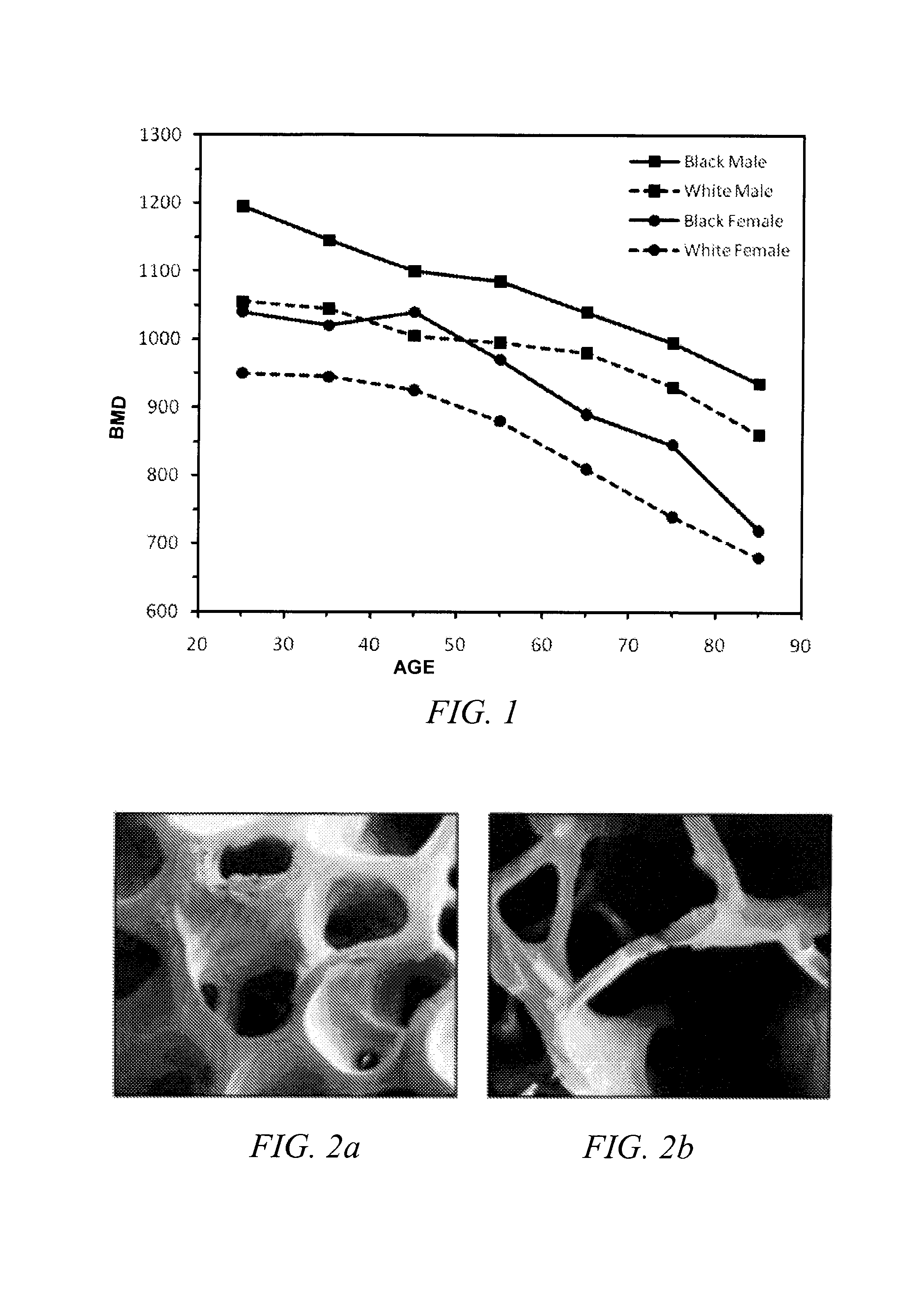 Methods of treating degenerative bone conditions