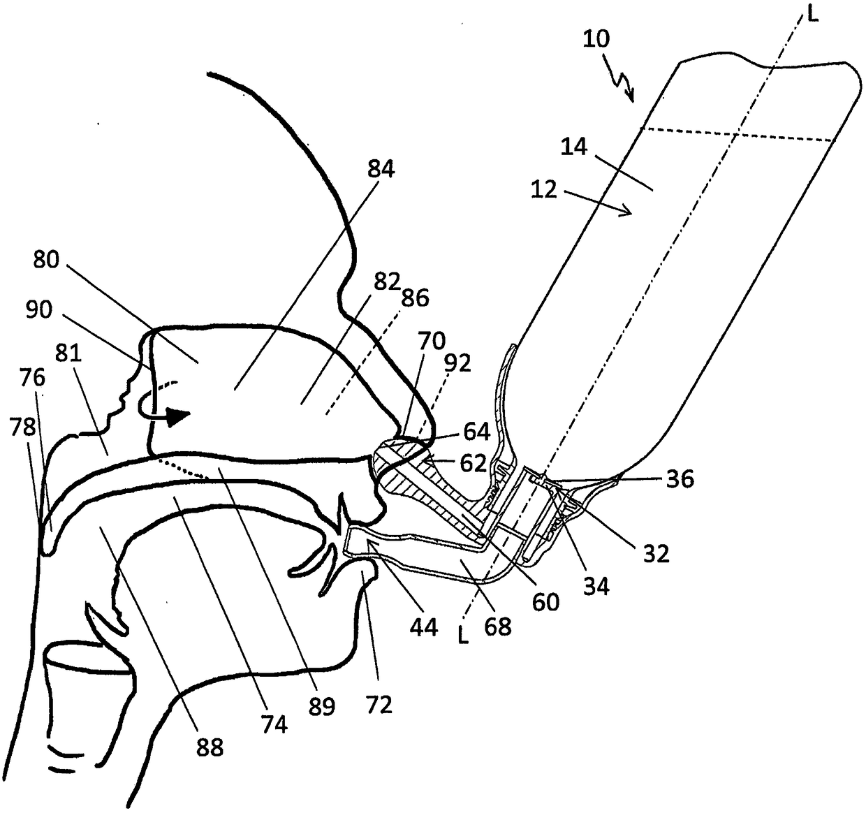 Nasal rinse with valve actuatable by breathing air