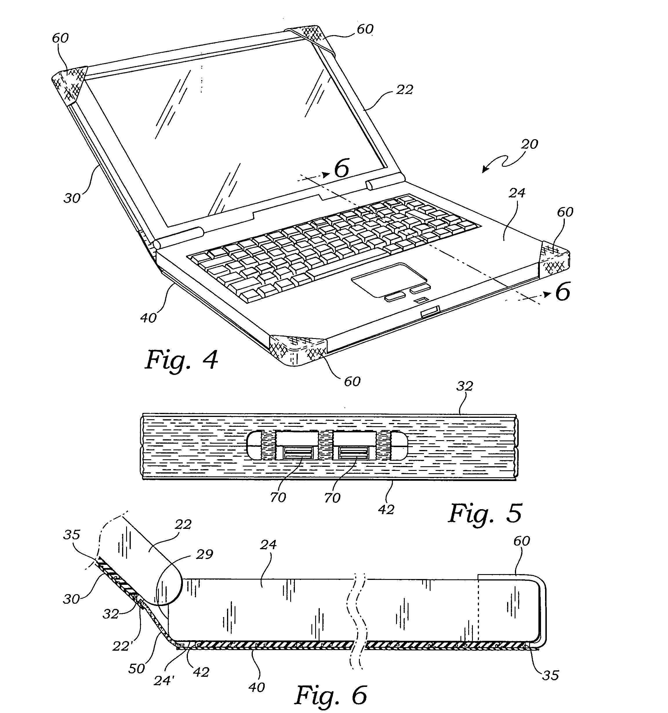 Scratch resistant skin for a laptop computer