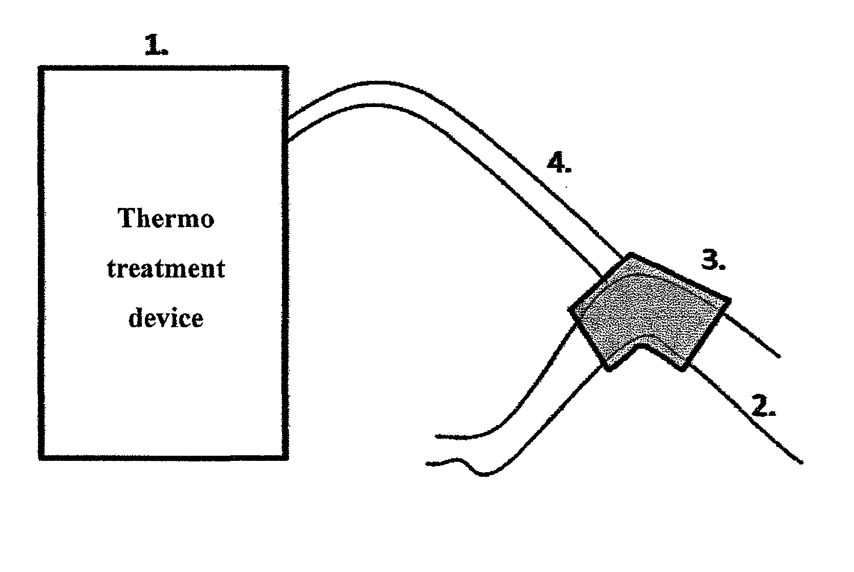 System for detection and treatment of infection or inflamation