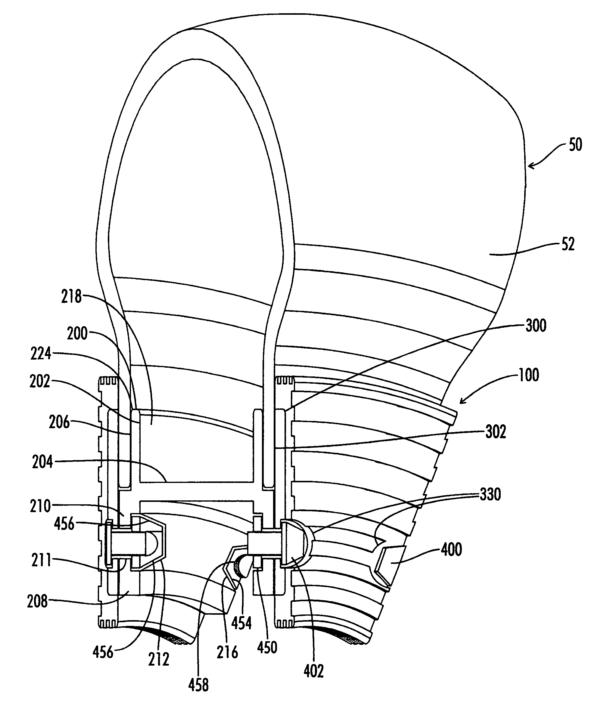 Supplemental tread tire bead lock