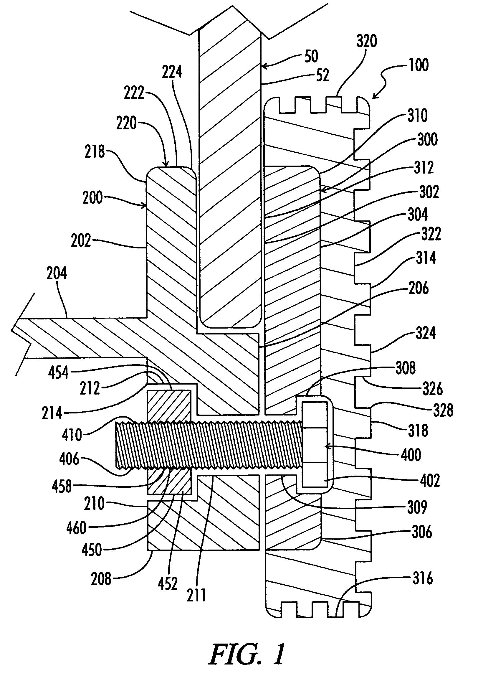 Supplemental tread tire bead lock