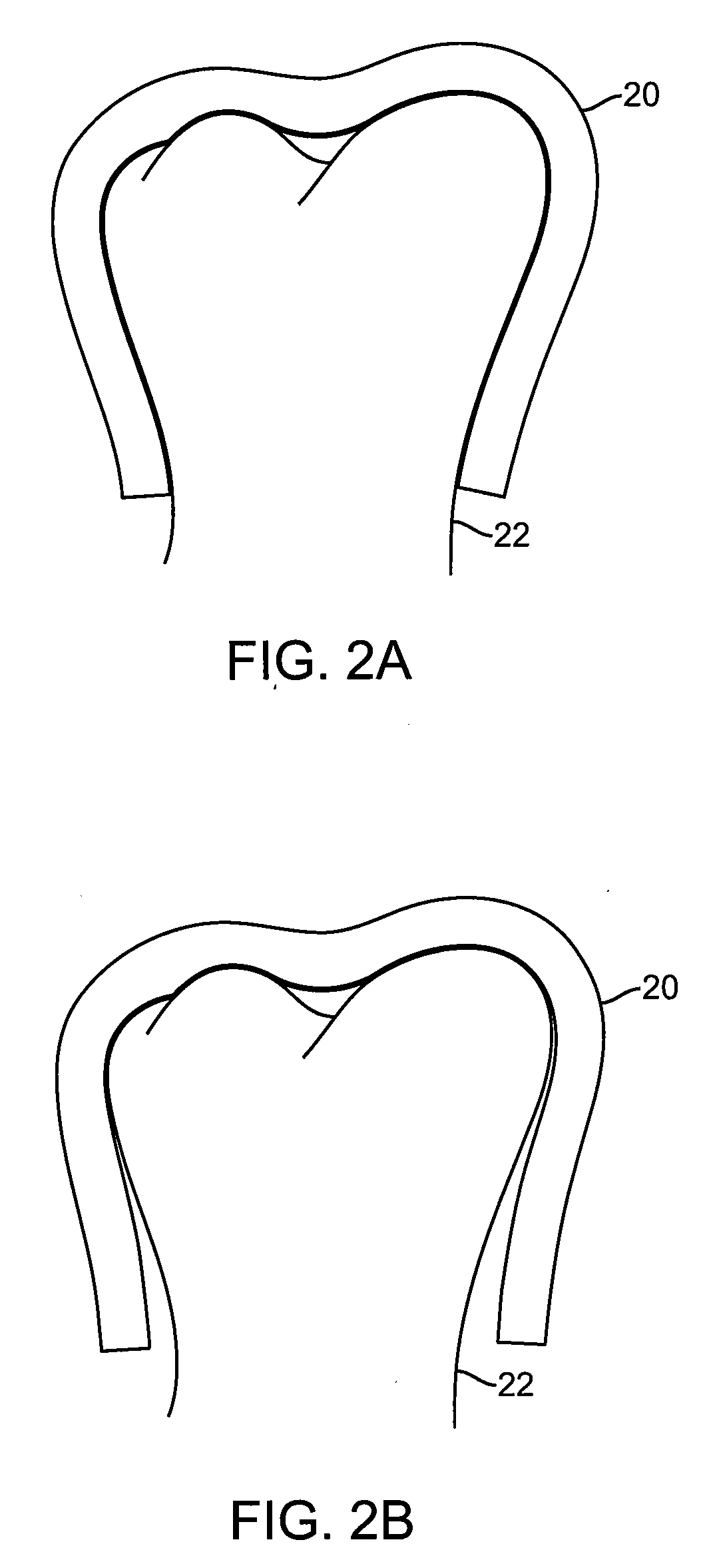 Shape engineered aligner - auto shaping