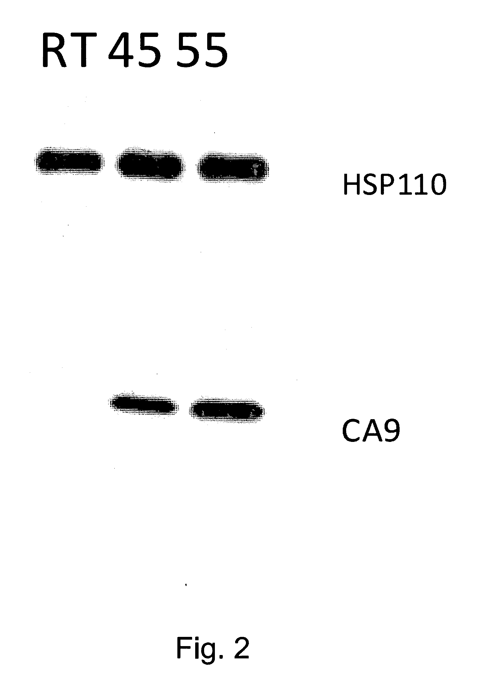 Use of recombinant heat shock protein complexed to kidney cancer antigen