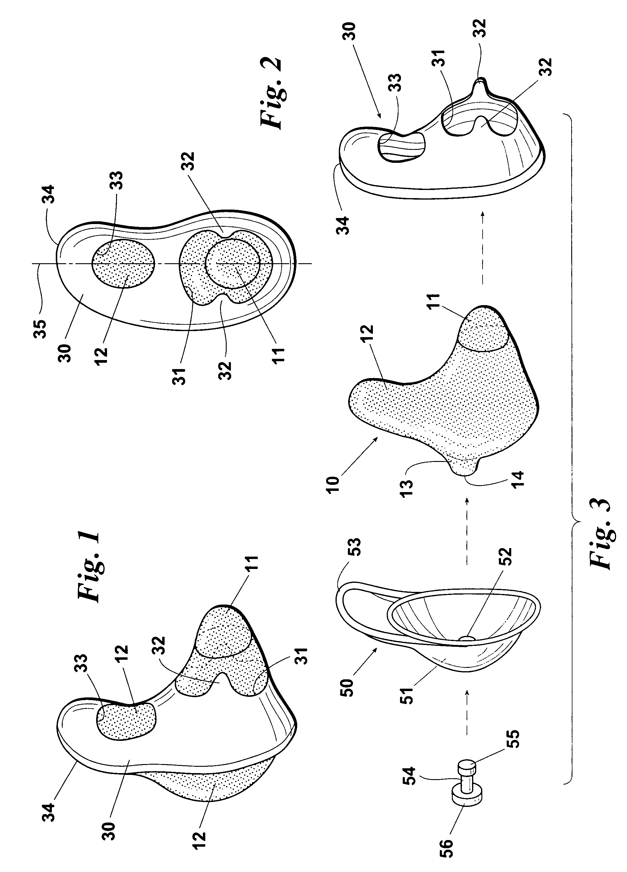 Disposable plug for warming the inner ear