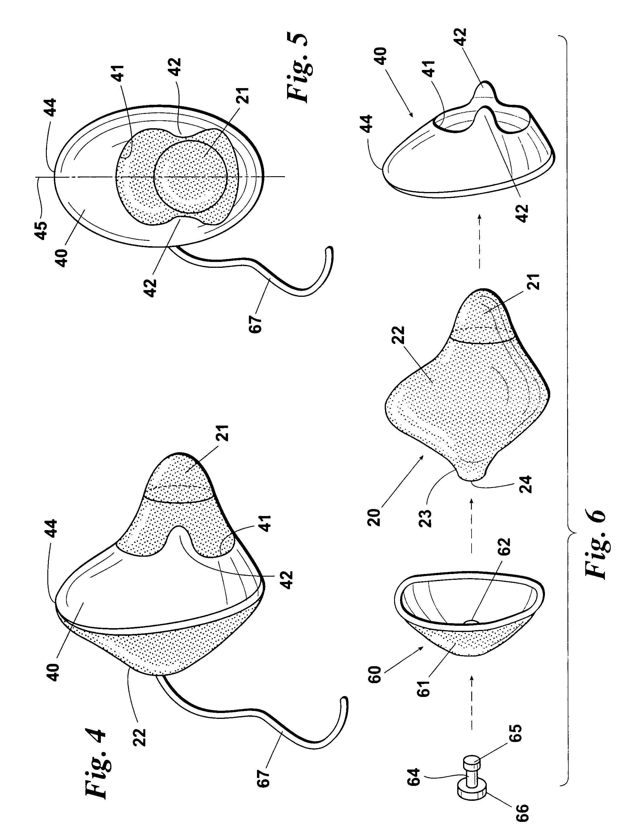 Disposable plug for warming the inner ear