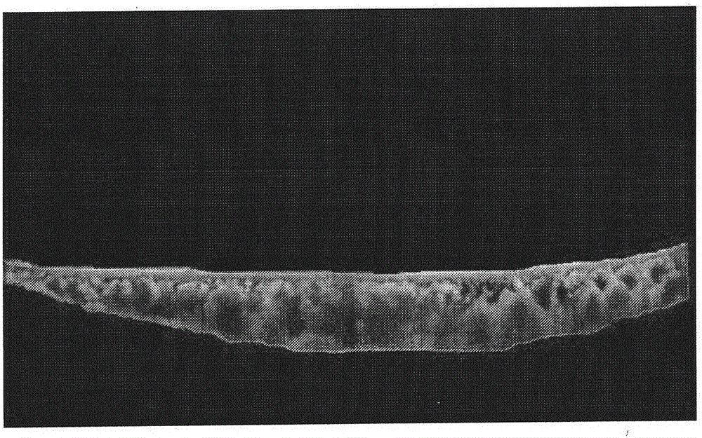 Method for measuring diameter of maximum choroid blood vessel based on image segmentation