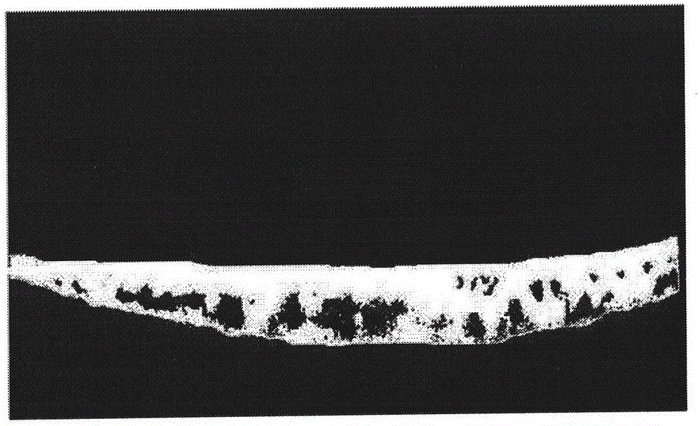 Method for measuring diameter of maximum choroid blood vessel based on image segmentation