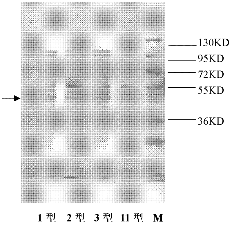 Monoclonal antibody against riemerella anatipestifer (RA)