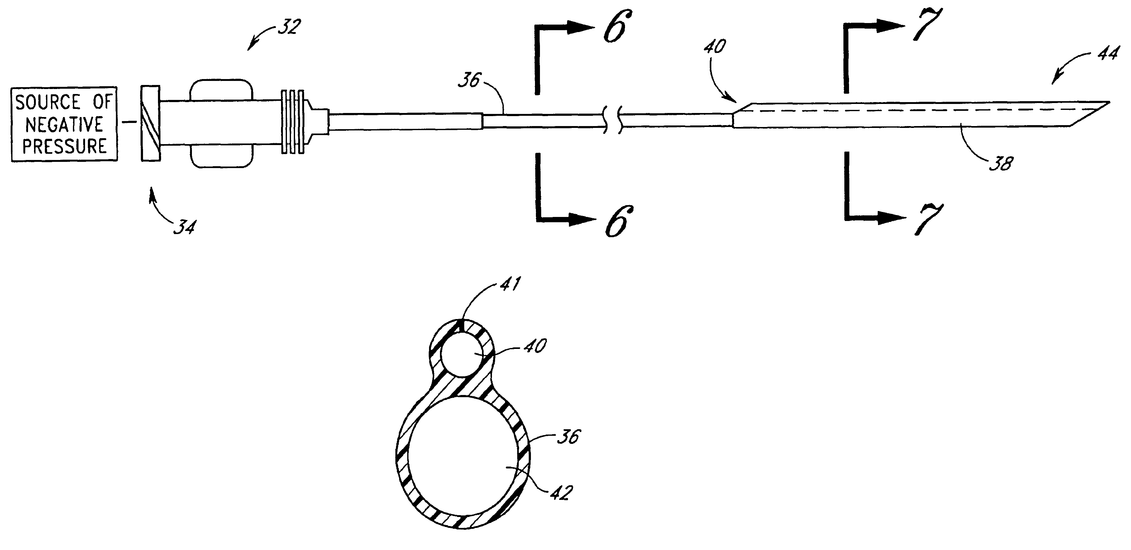 Aspiration catheter