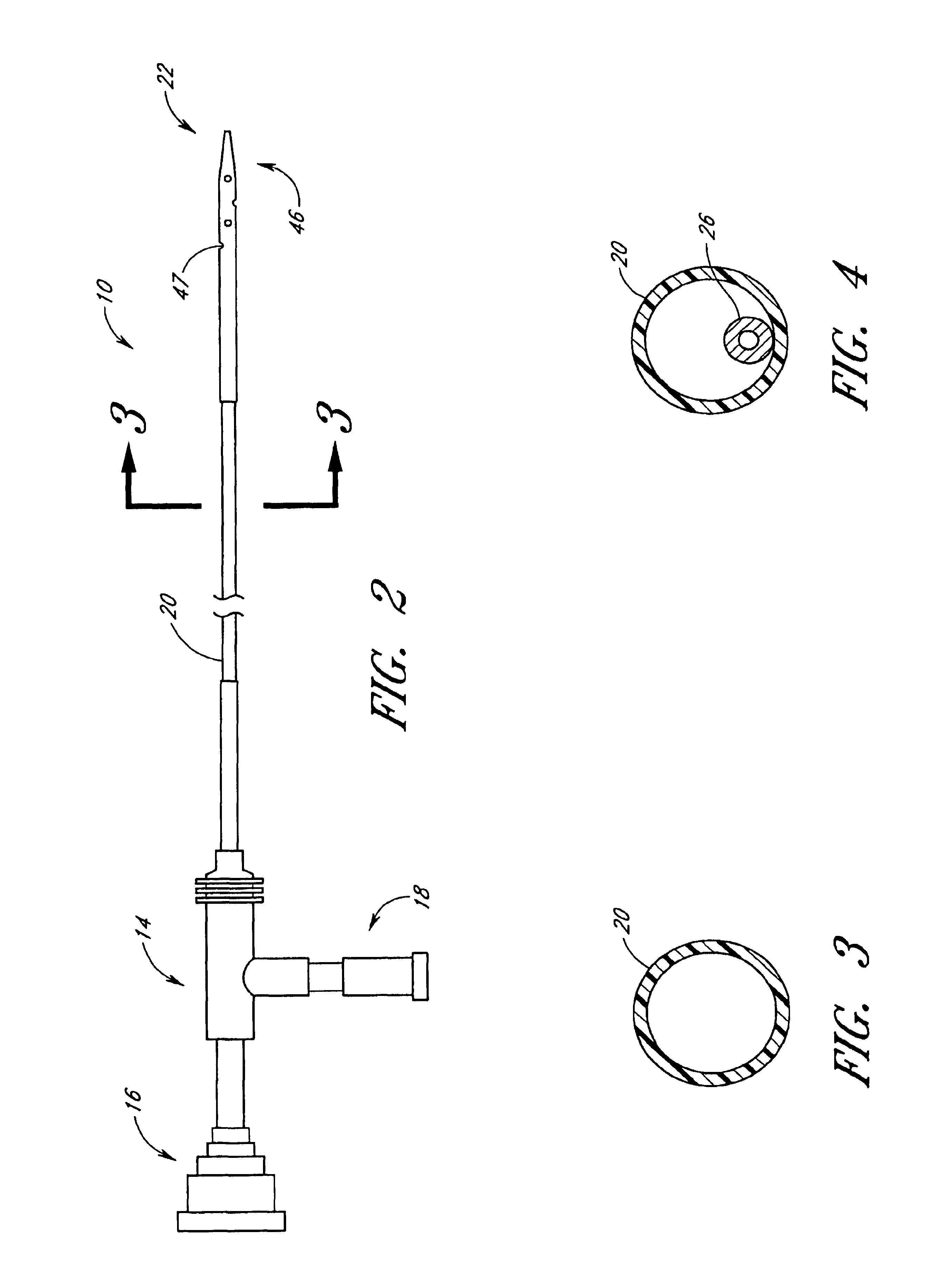 Aspiration catheter