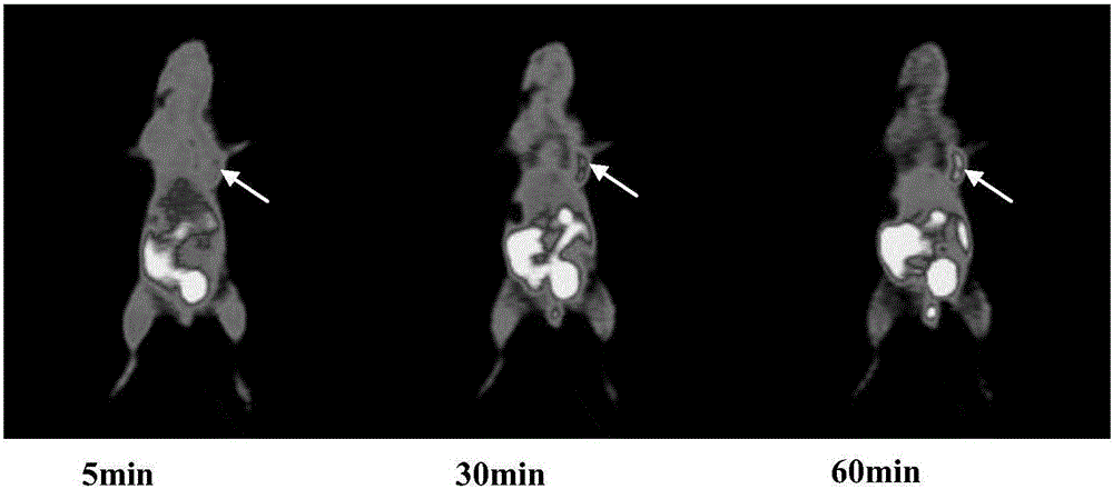 PET tracer agent precursor-2-nitroimidazole compound and preparation method thereof