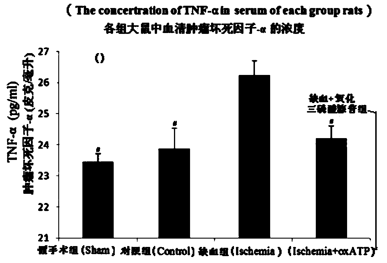 Application of P2X7 antagonist oxATP in preparation of medicament for treating myocardial ischemia injuries and hypertension/sympathetic nervous system diseases