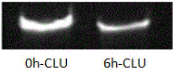 siRNA set for inhibiting cluster protein gene expression and application thereof