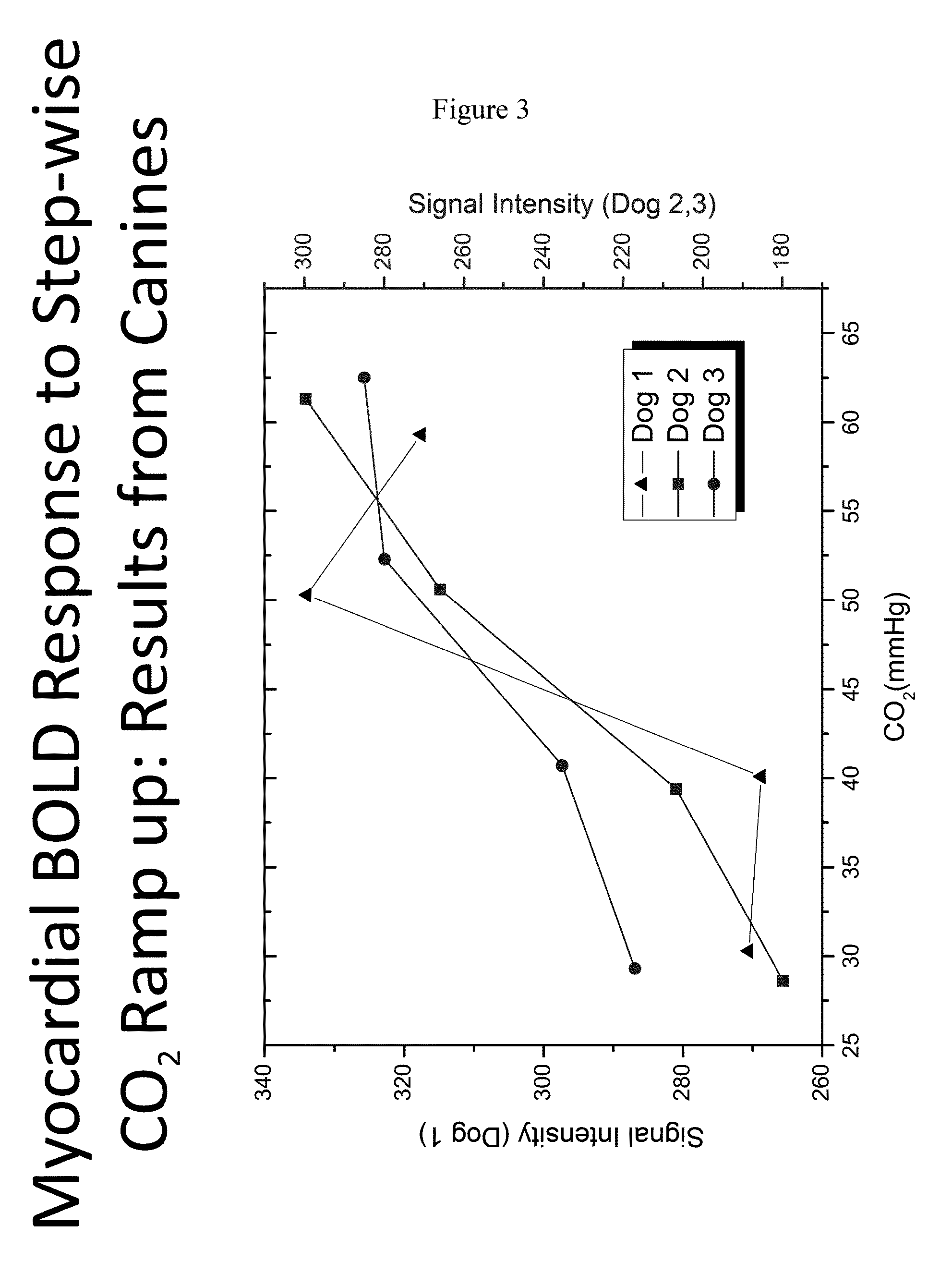 Assessment of coronary heart disease with carbon dioxide