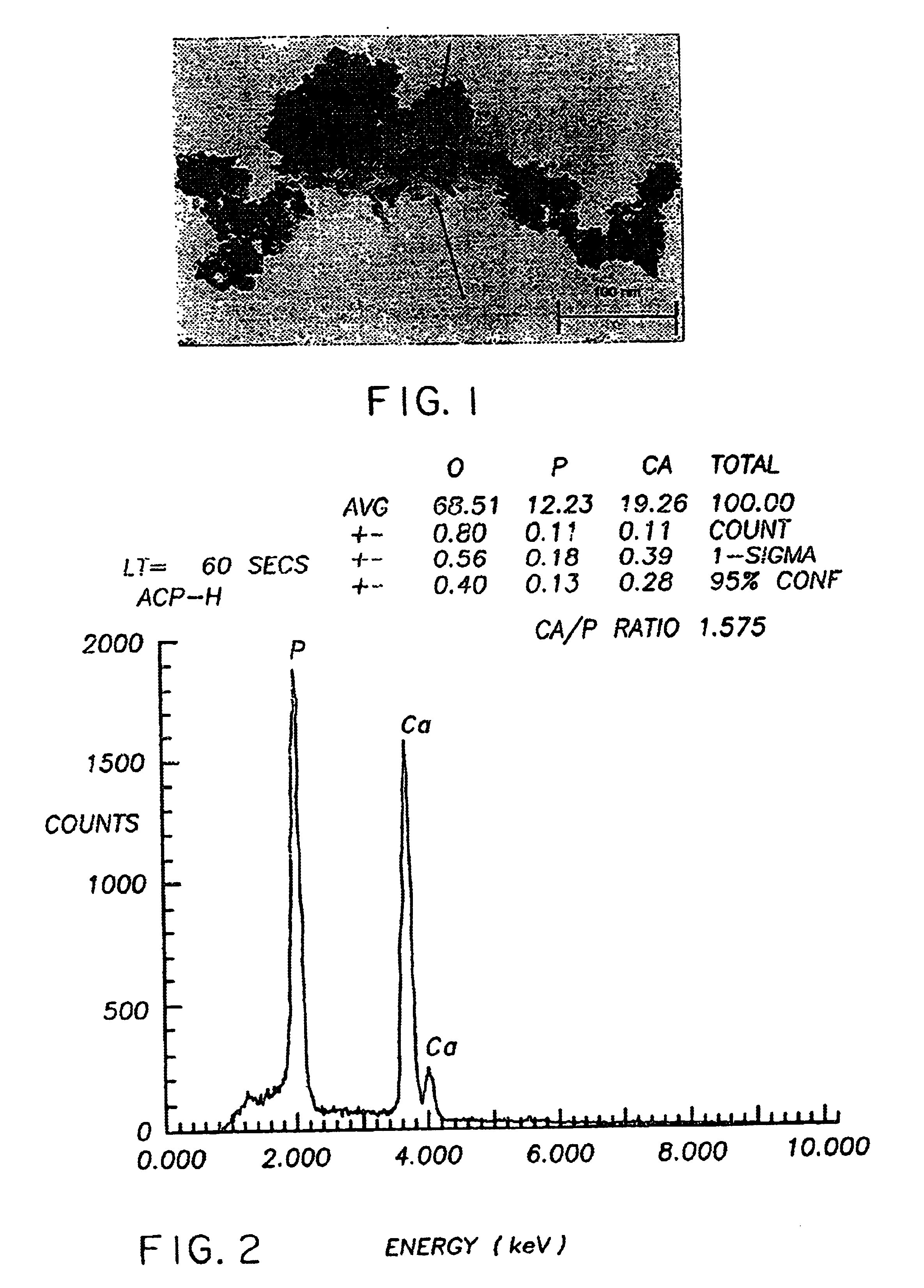 Method of preparing a poorly crystalline calcium phosphate and methods of its use