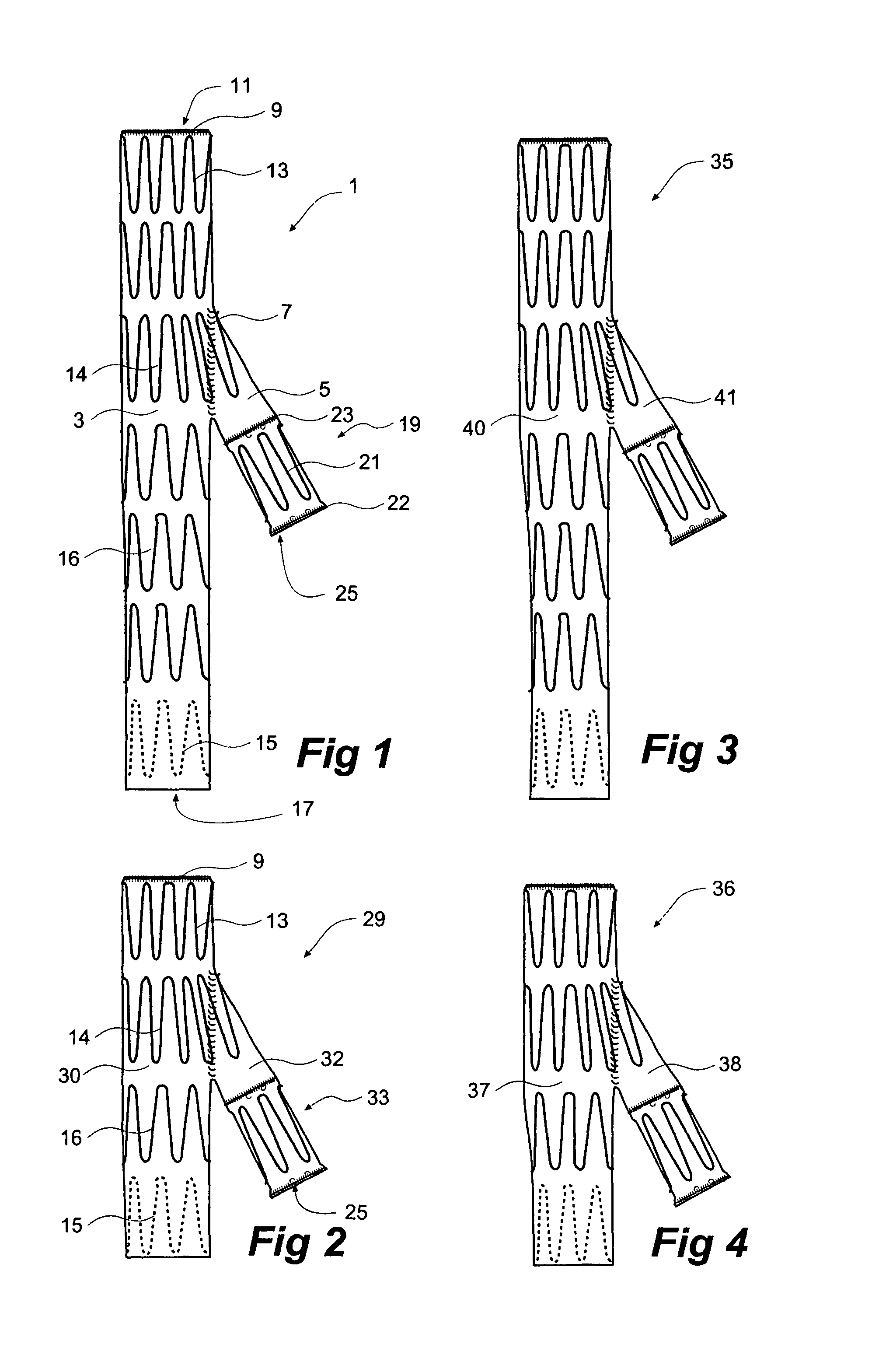 Iliac artery stent graft