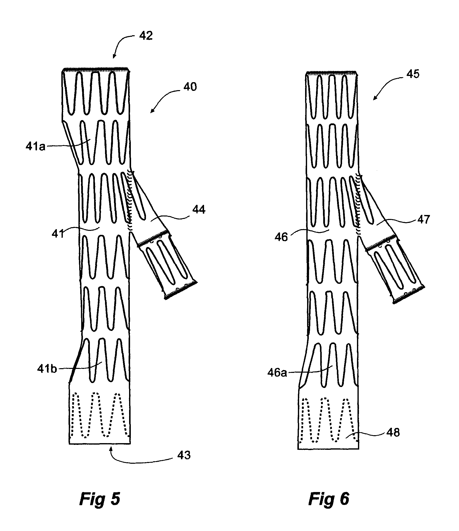 Iliac artery stent graft