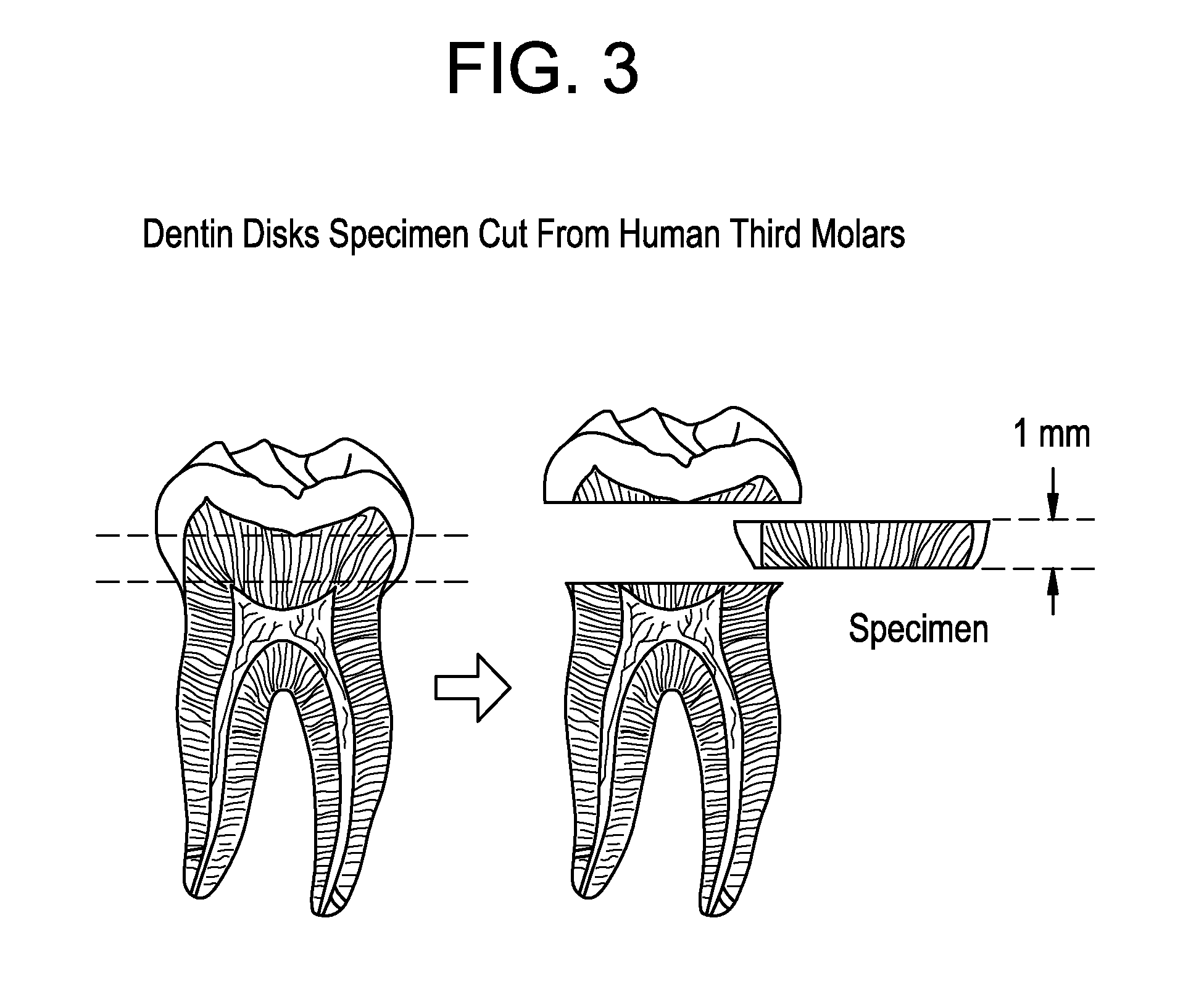 Oral care compositions for treatment of sensitive teeth