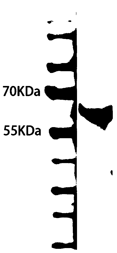 Tissue repair protein CHRD, and coding gene and applications thereof