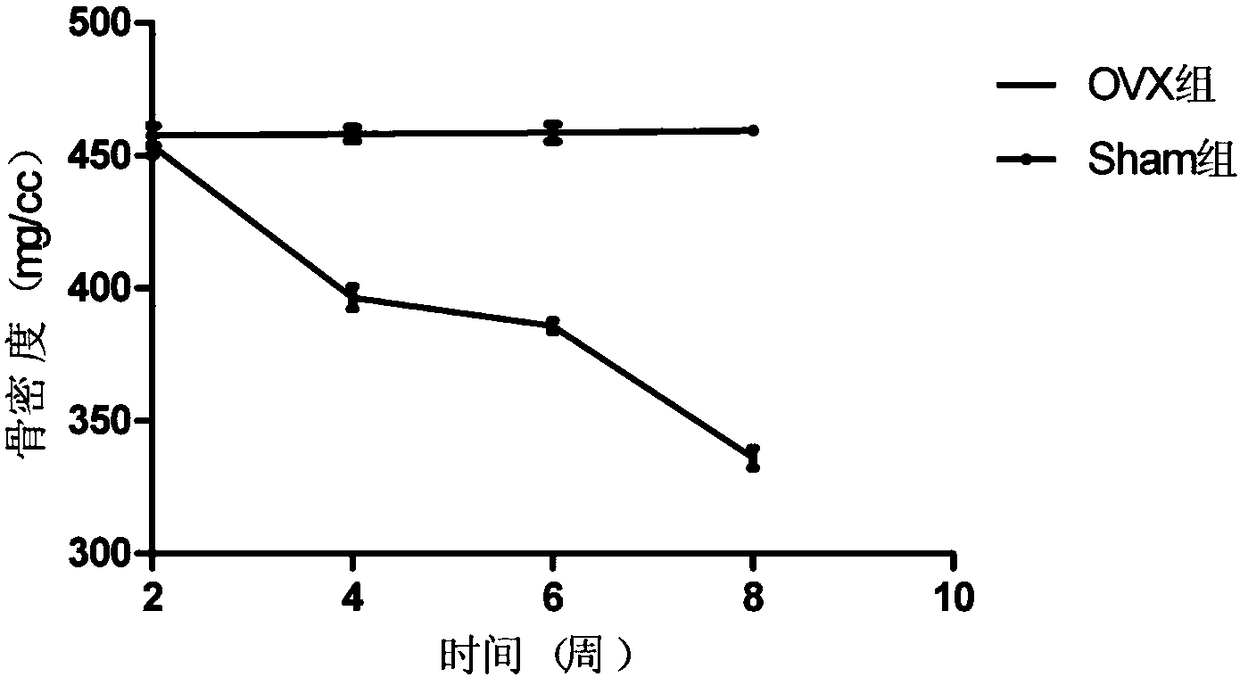 A kit for early prediction of osteoporosis