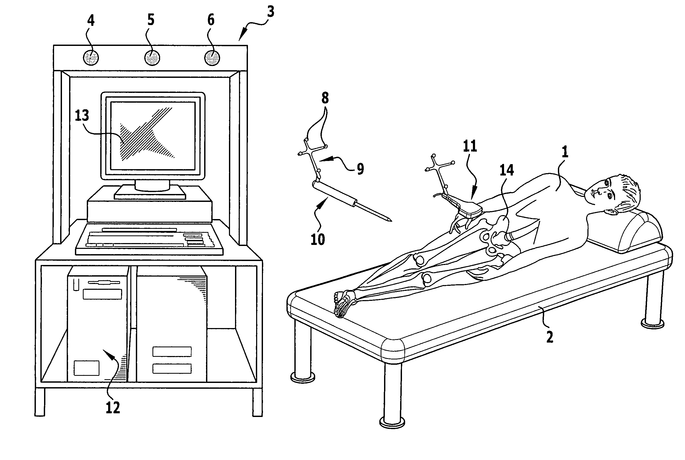 Method and apparatus for determining the angular position of an acetabulum in a pelvic bone