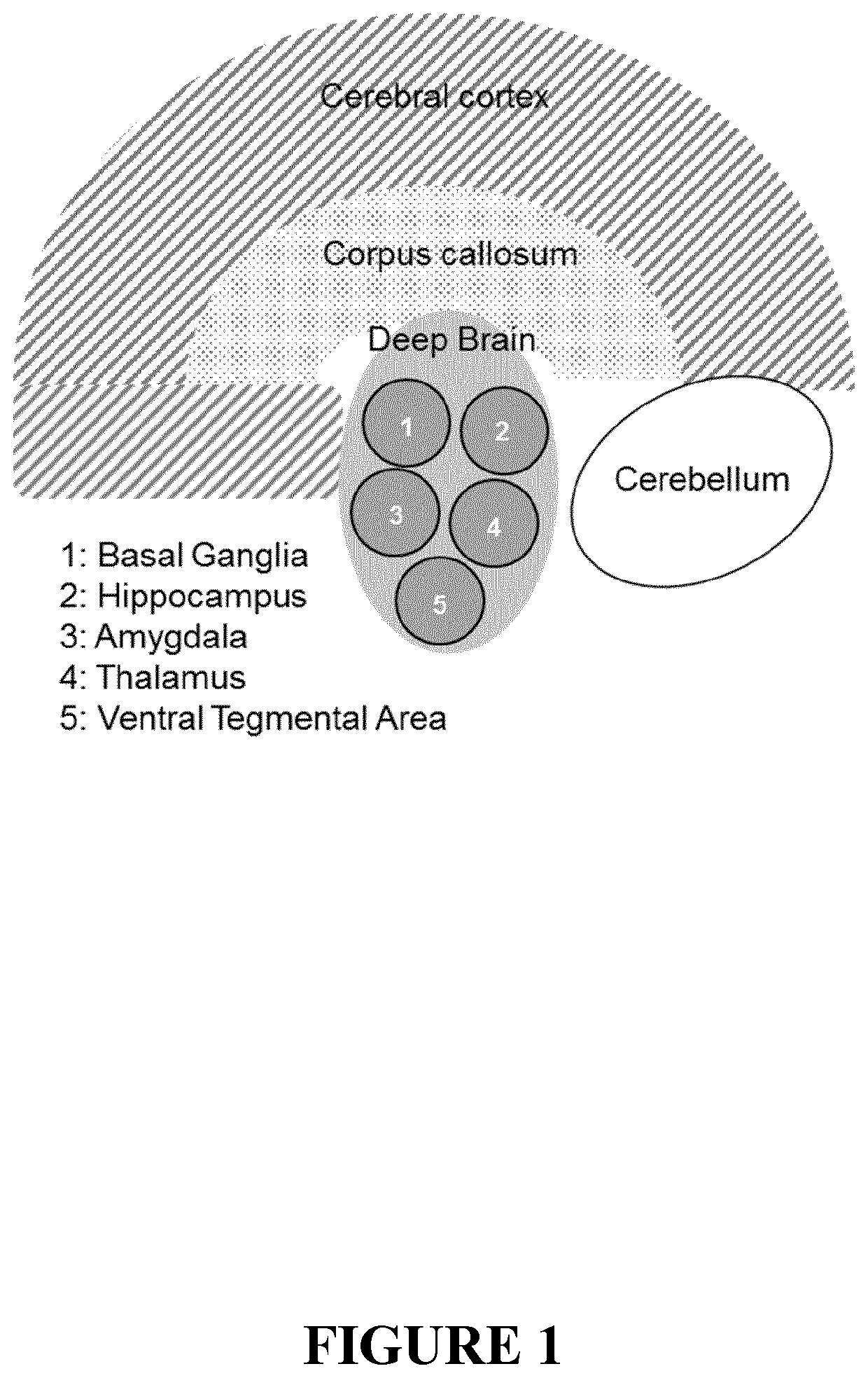 Nanoparticles for use for treating a neuronal disorder