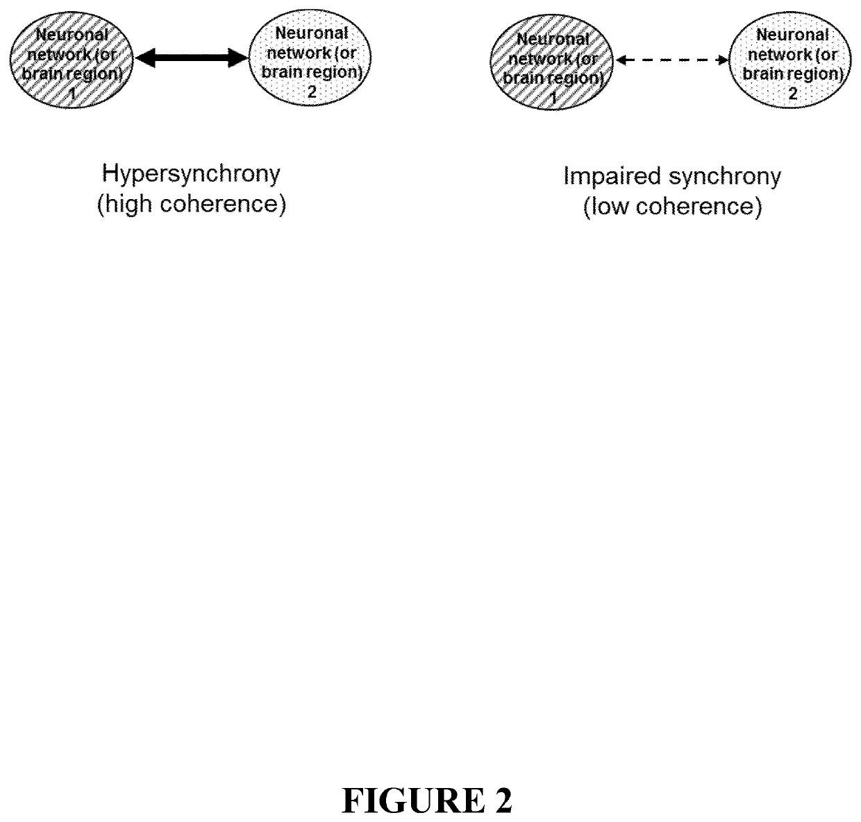 Nanoparticles for use for treating a neuronal disorder