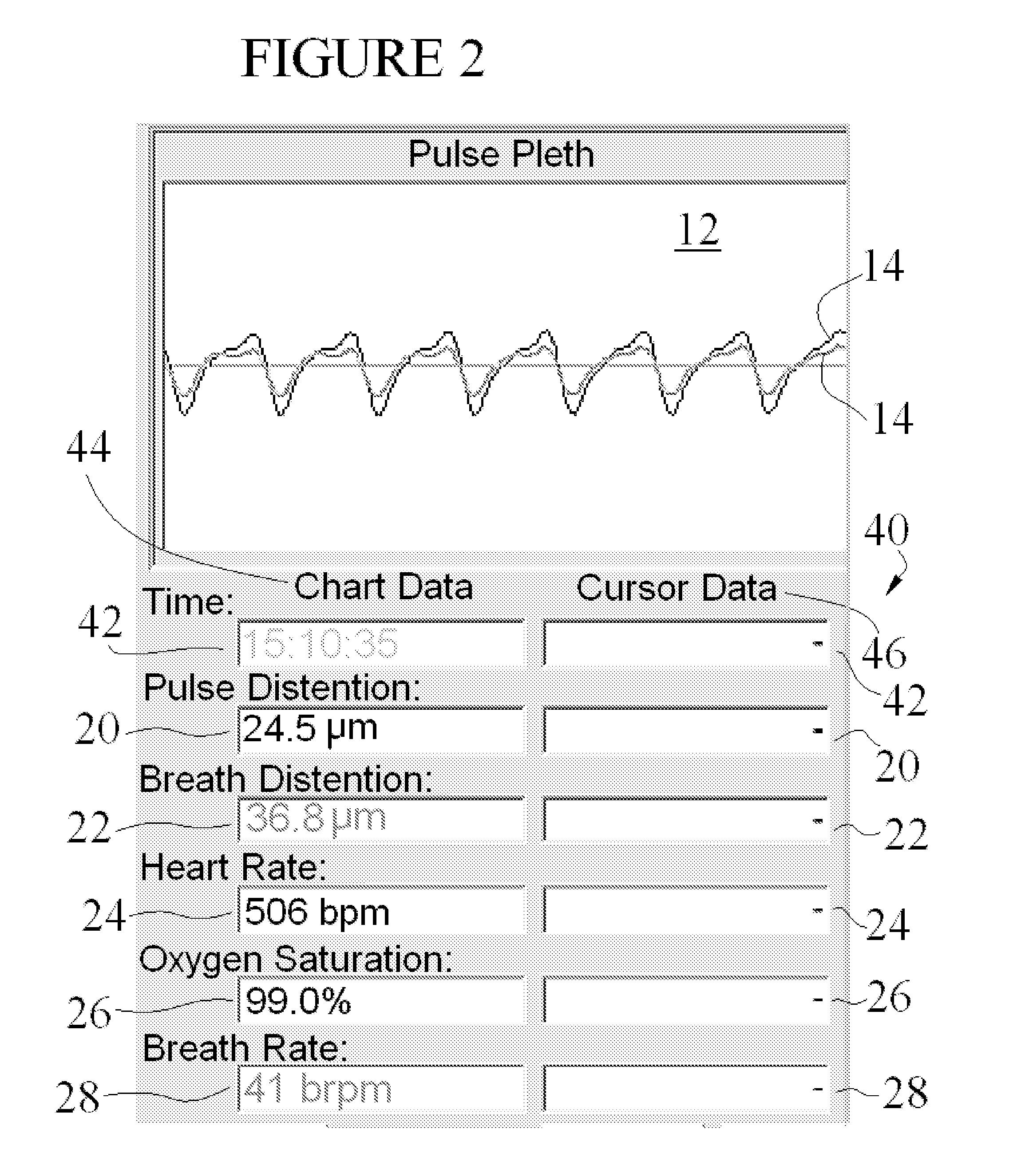 Small Animal Pulse Oximeter User Interface