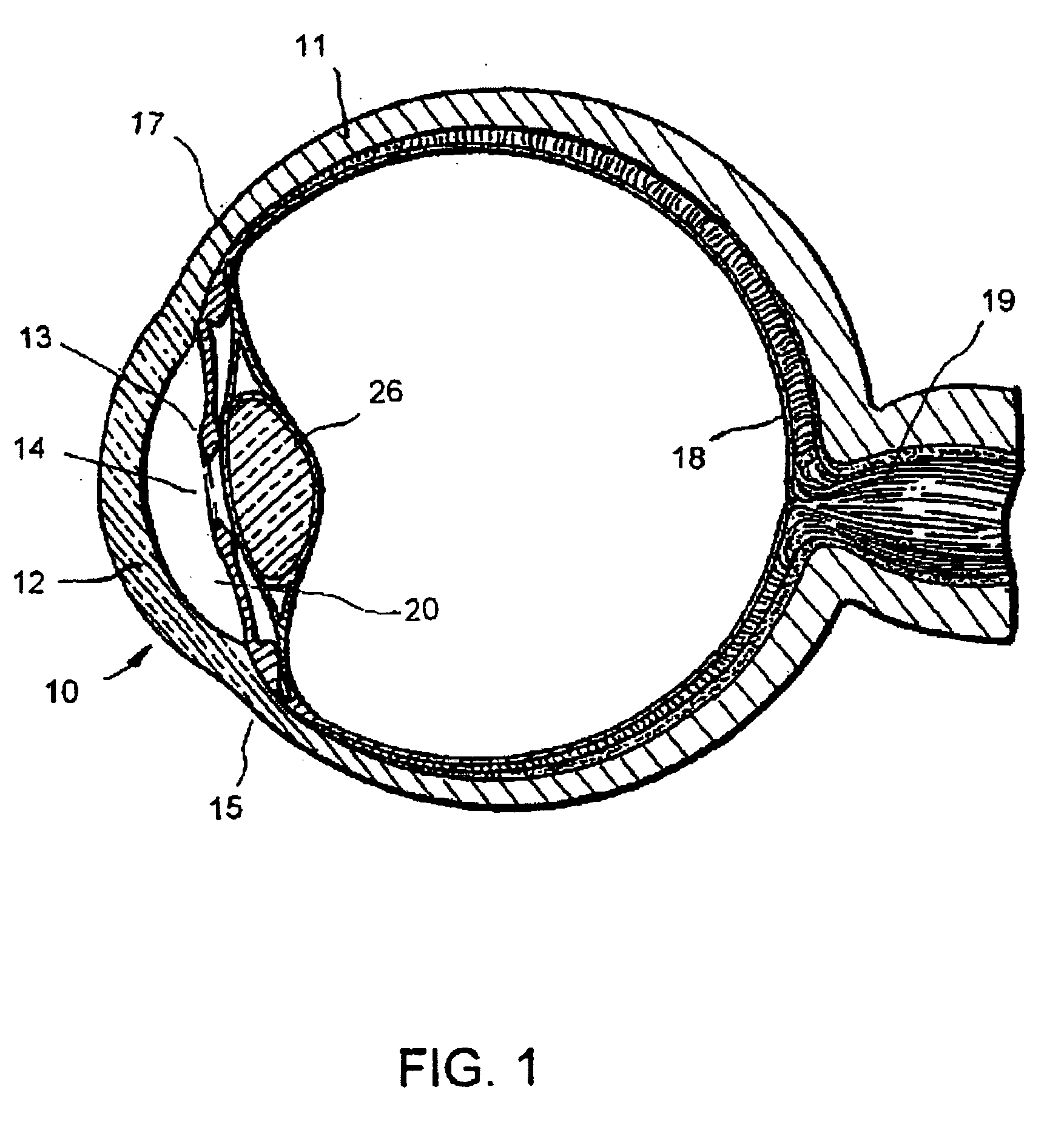 Glaucoma implant with multiple openings