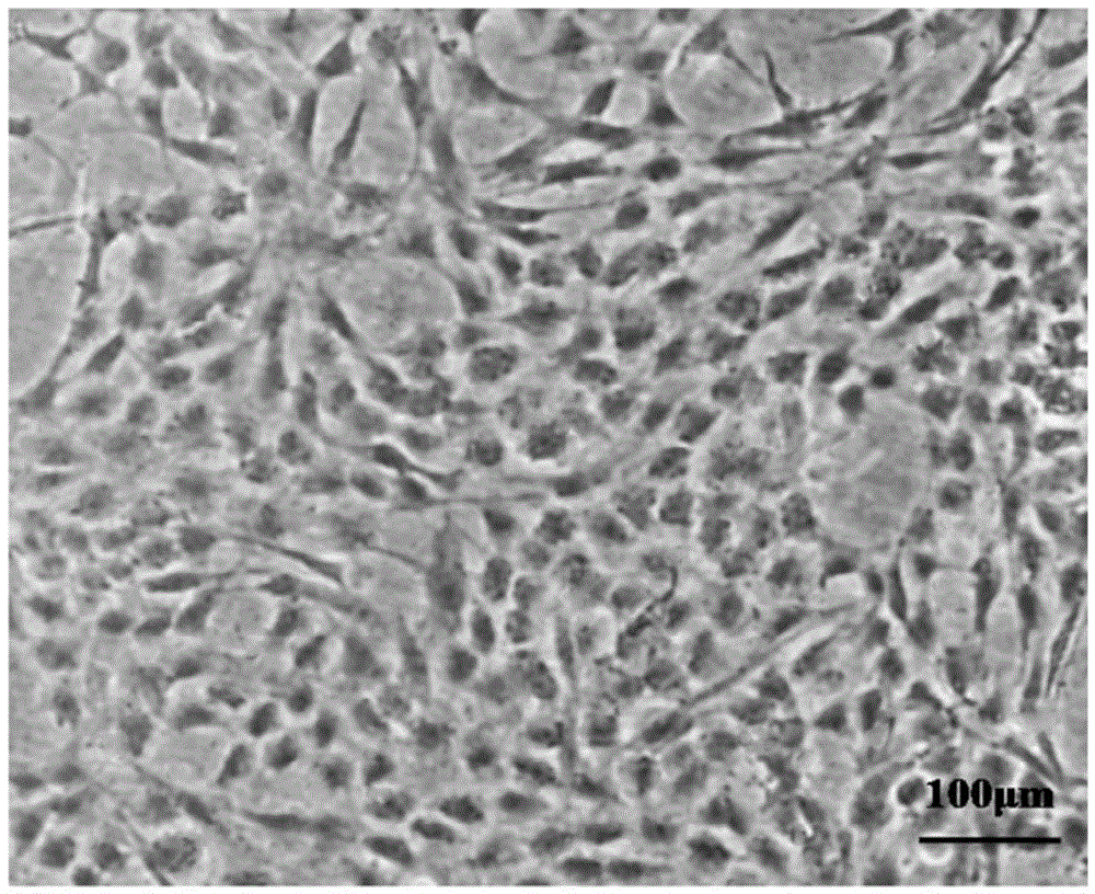 Tumour universal type fibroblast vaccine as well as preparation method and applications thereof