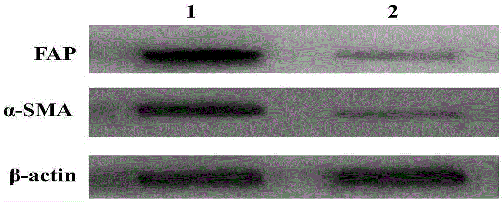 Tumour universal type fibroblast vaccine as well as preparation method and applications thereof