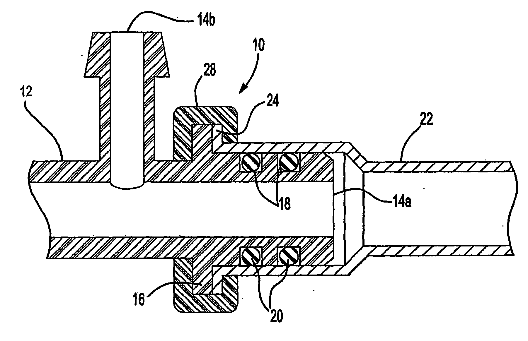 Metal to plastic fluid connection with overmolded anti-rotation retainer